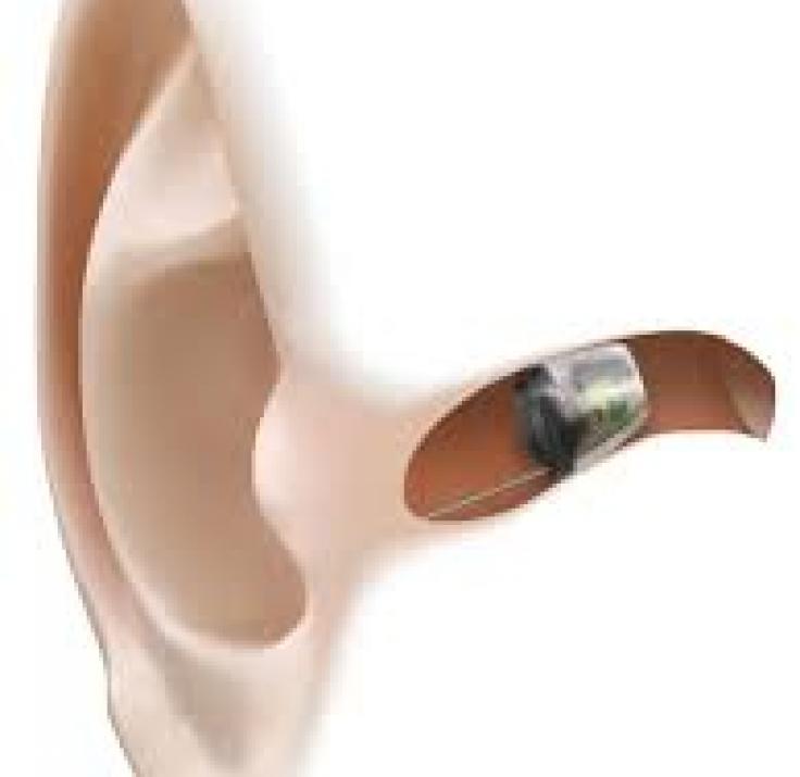 OTICON RIA IIC - CIC Audiflex aparelhos auditivos